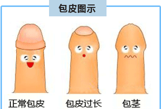 包皮,包皮过长