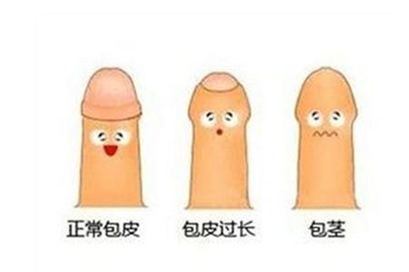 包皮手术多少钱